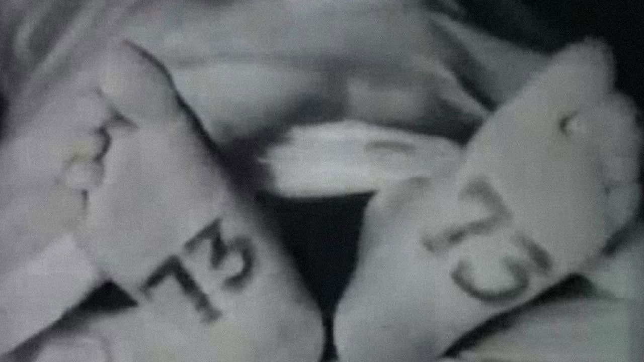 Baldness Will Be Defeated