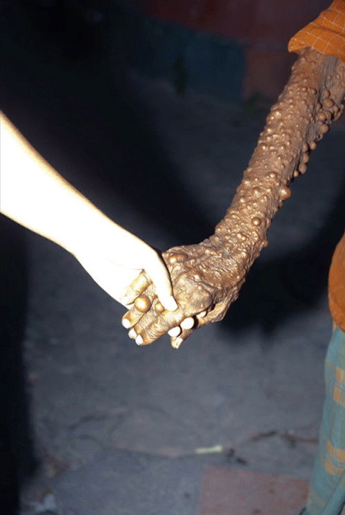 The Lost Head and the Bird