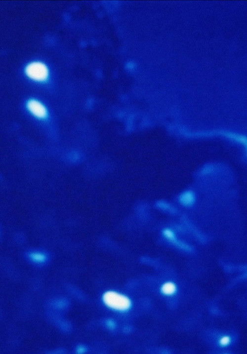 Morphology of a Dream