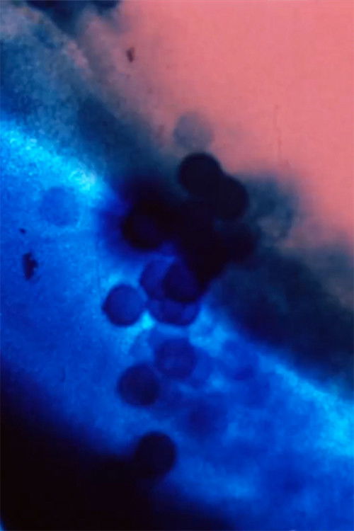 Don't Look Directly into the Sun